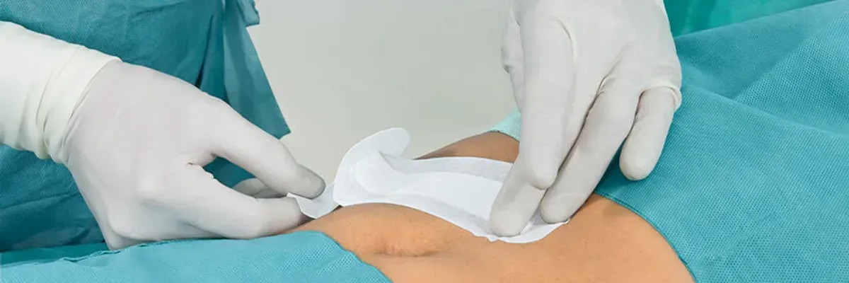 Cara Merawat Luka Operasi agar Cepat Sembuh